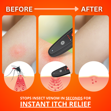 Sting Stick Bug Bite Relief Device Chemical-Free Heat Therapy Rechargeable Pen